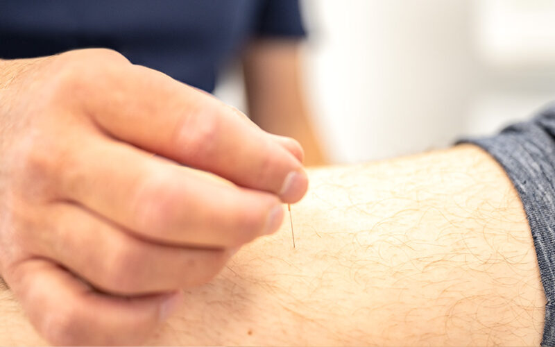 Akupunktur in München SüdWest Orthopädie Freiham